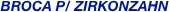  BrOCA P/ ZIRKONZAHN 

      